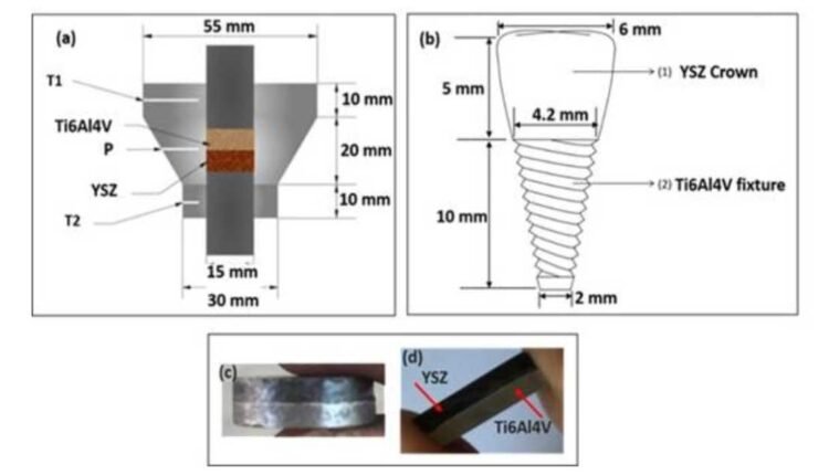 Single-piece dental implant reduces surgical needs